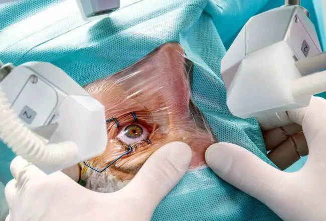 Eye Health: Macular Degeneration